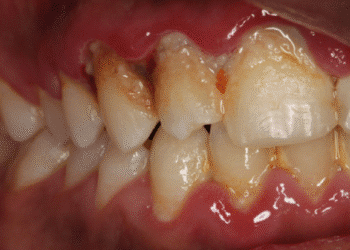 ThS.BS Nguyễn Quang Tiến – CEO Bệnh viện Răng Hàm Mặt Sài Gòn hướng dẫn cách xử lý khi lợi bị thâm đen